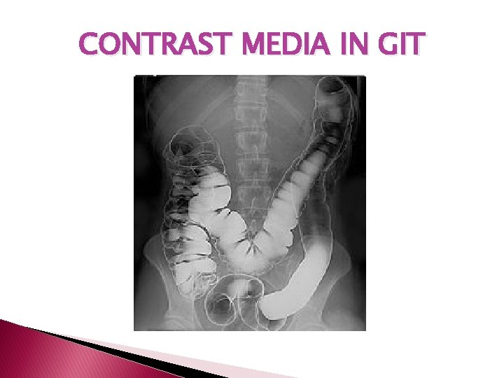 CONTRAST MEDIA IN GIT CONTRAST MEDIA IN GIT