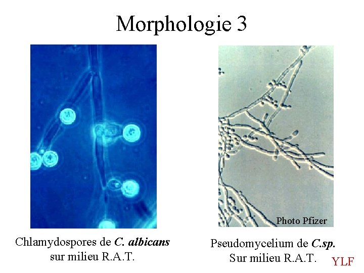 Morphologie 3 Photo Pfizer Chlamydospores de C. albicans sur milieu R. A. T. Pseudomycelium Morphologie 3 Photo Pfizer Chlamydospores de C. albicans sur milieu R. A. T. Pseudomycelium