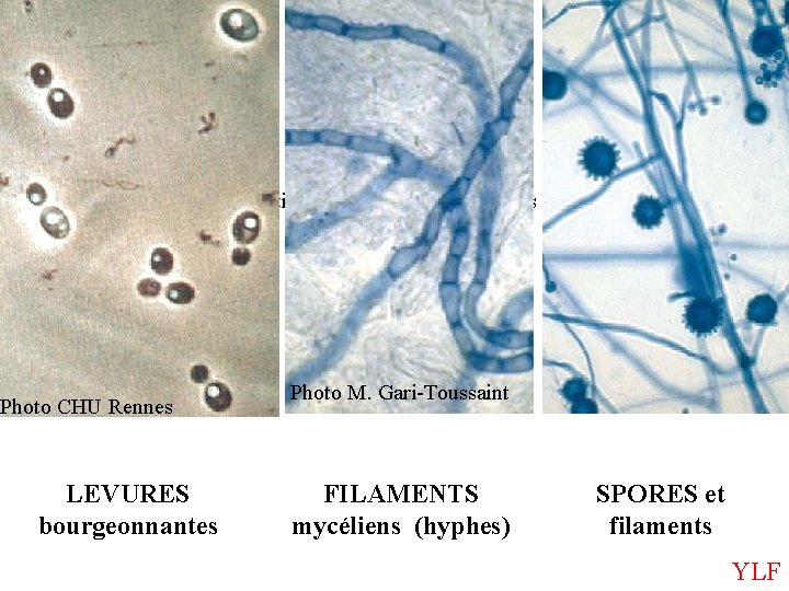 Illustration levures, filaments, spores Photo CHU Rennes LEVURES bourgeonnantes Photo M. Gari-Toussaint FILAMENTS mycéliens