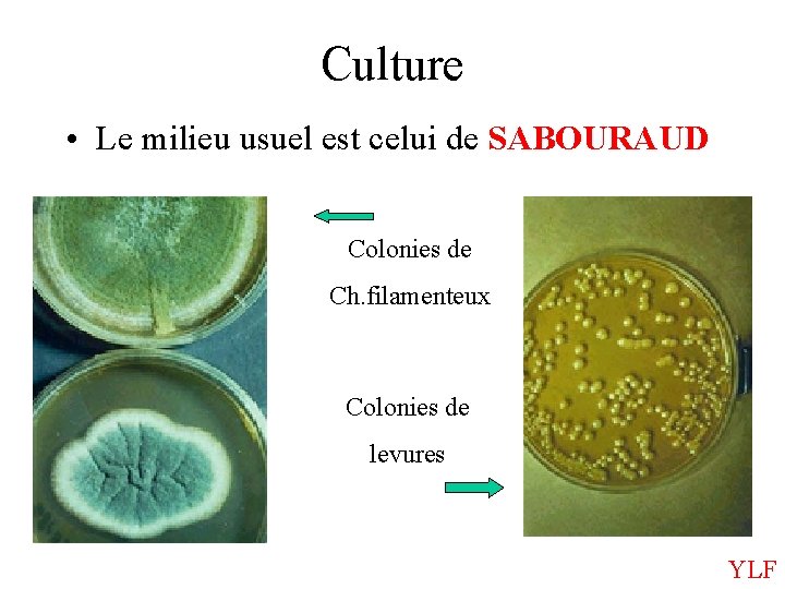 Culture • Le milieu usuel est celui de SABOURAUD Colonies de Ch. filamenteux Colonies