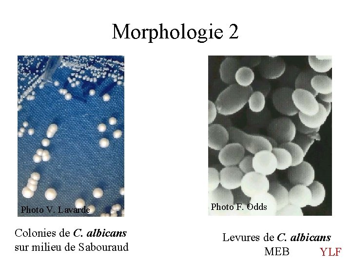 Morphologie 2 Photo V. Lavarde Colonies de C. albicans sur milieu de Sabouraud Photo