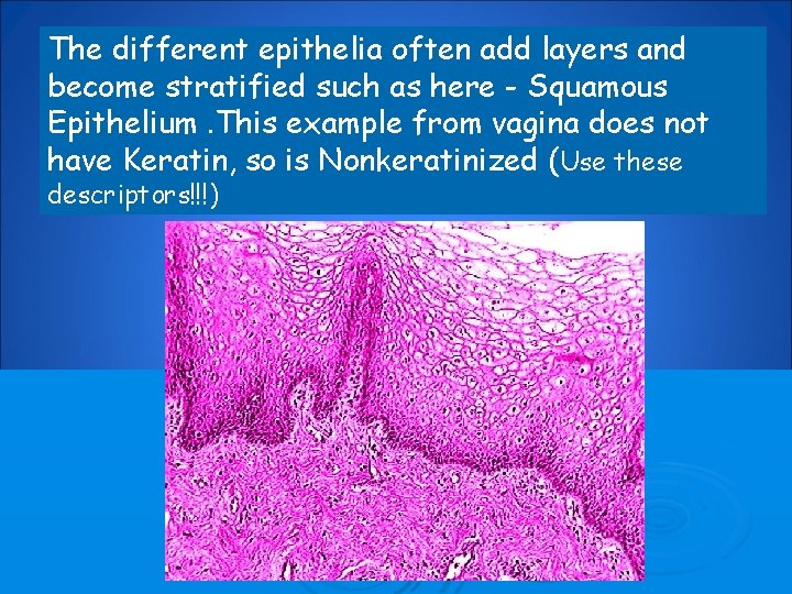 The different epithelia often add layers and become stratified such as here - Squamous