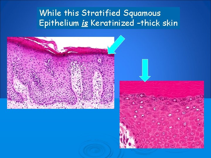 While this Stratified Squamous Epithelium is Keratinized –thick skin 