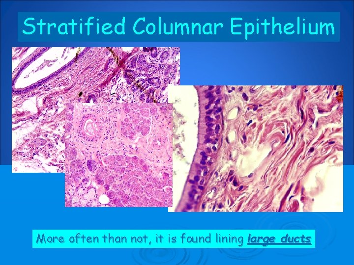 Stratified Columnar Epithelium More often than not, it is found lining large ducts 