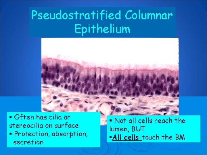 Pseudostratified Columnar Epithelium § Often has cilia or stereocilia on surface § Protection, absorption,