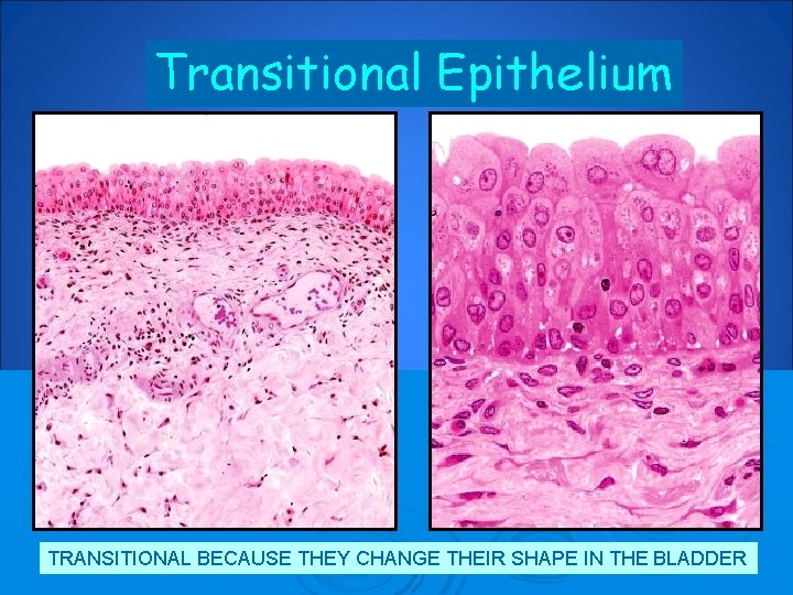 Transitional Epithelium TRANSITIONAL BECAUSE THEY CHANGE THEIR SHAPE IN THE BLADDER 