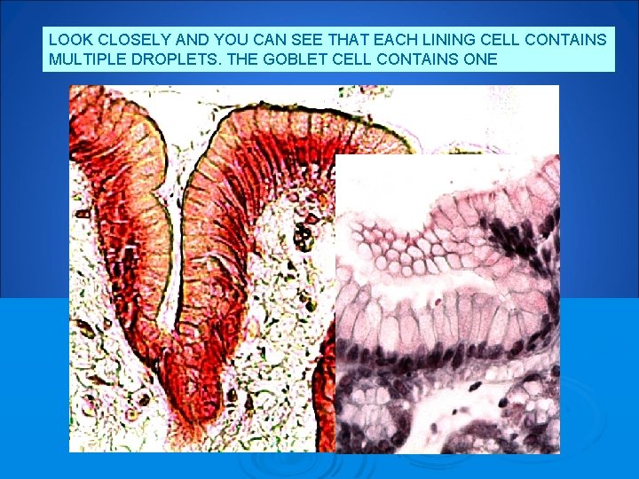 LOOK CLOSELY AND YOU CAN SEE THAT EACH LINING CELL CONTAINS MULTIPLE DROPLETS. THE