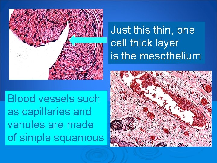 Just this thin, one cell thick layer is the mesothelium Blood vessels such as