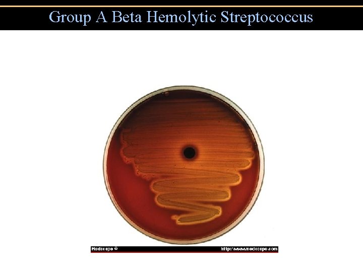 Group A Beta Hemolytic Streptococcus 