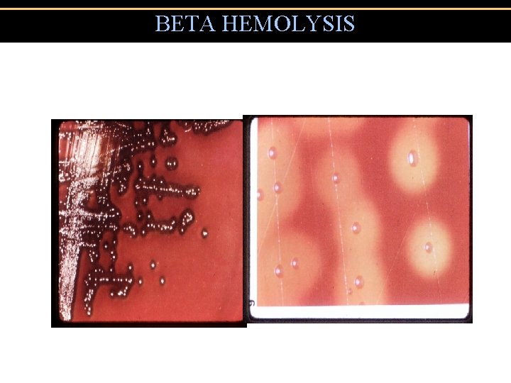 BETA HEMOLYSIS 