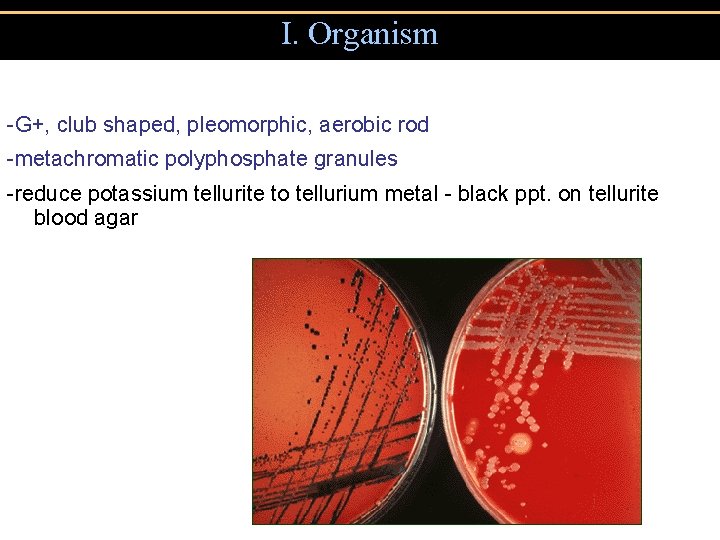 I. Organism -G+, club shaped, pleomorphic, aerobic rod -metachromatic polyphosphate granules -reduce potassium tellurite