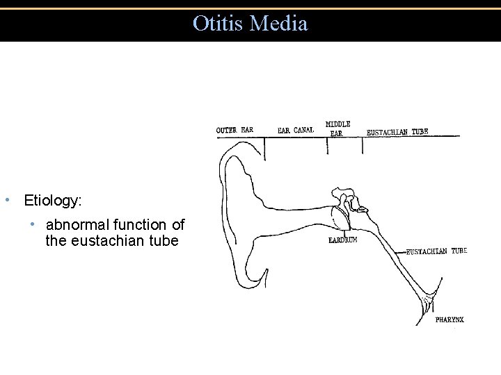 Otitis Media • Etiology: • abnormal function of the eustachian tube 