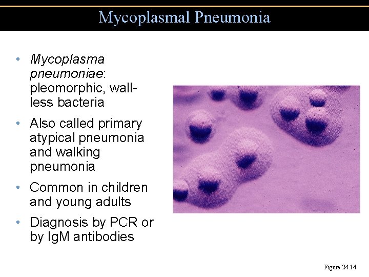 Mycoplasmal Pneumonia • Mycoplasma pneumoniae: pleomorphic, wallless bacteria • Also called primary atypical pneumonia