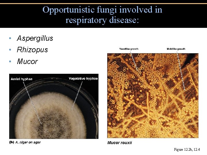 Opportunistic fungi involved in respiratory disease: • Aspergillus • Rhizopus • Mucor rouxii Figure
