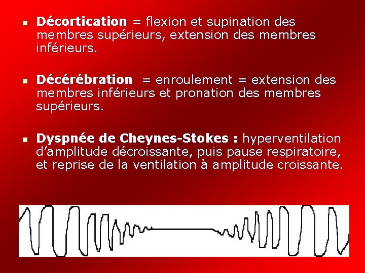 n n n Décortication = flexion et supination des membres supérieurs, extension des membres