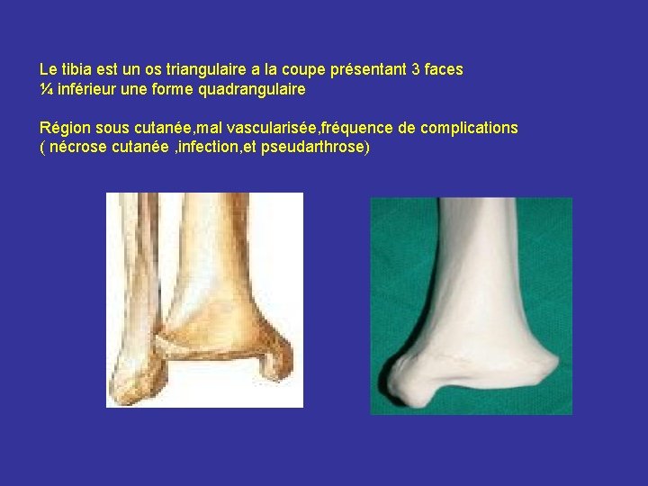 Le tibia est un os triangulaire a la coupe présentant 3 faces ¼ inférieur Le tibia est un os triangulaire a la coupe présentant 3 faces ¼ inférieur