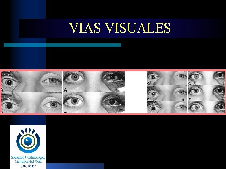 VIAS VISUALES 