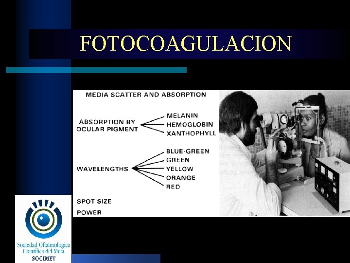 FOTOCOAGULACION 