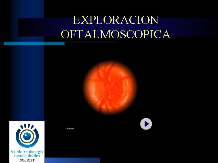 EXPLORACION OFTALMOSCOPICA 