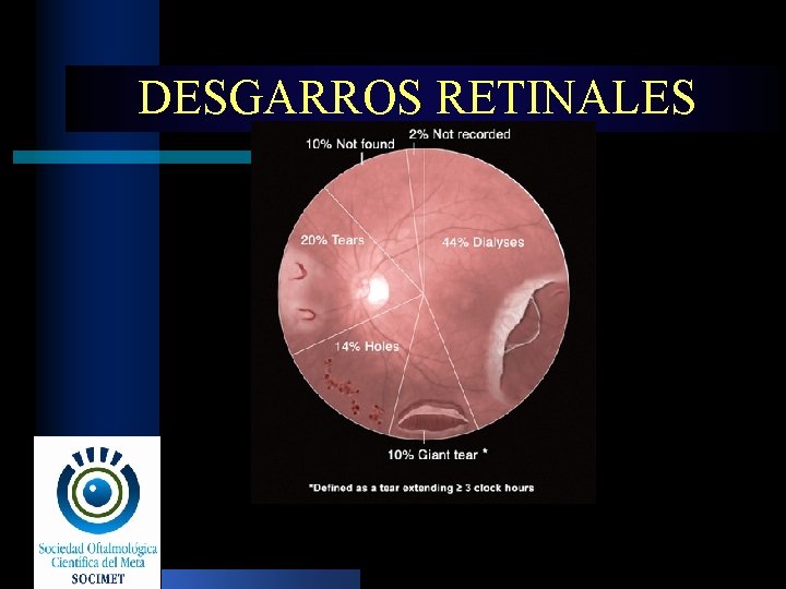 DESGARROS RETINALES 