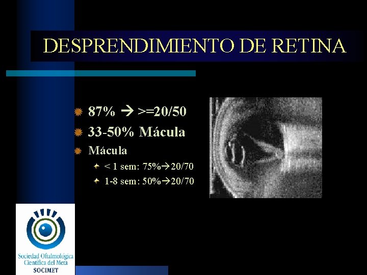 DESPRENDIMIENTO DE RETINA 87% >=20/50 33 -50% Mácula < 1 sem: 75% 20/70 1