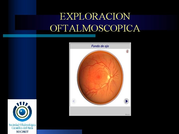 EXPLORACION OFTALMOSCOPICA 