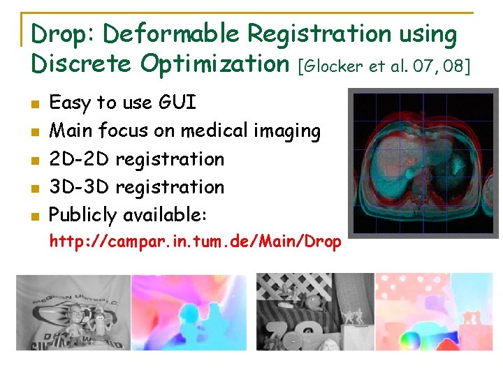 Drop: Deformable Registration using Discrete Optimization [Glocker et al. 07, 08] n n n