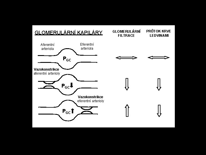 GLOMERULÁRNÍ KAPILÁRY Eferentní arteriola Aferentní arteriola PGC Vazokonstrikce aferentní arterioly PGC Vazokonstrikce eferentní arterioly