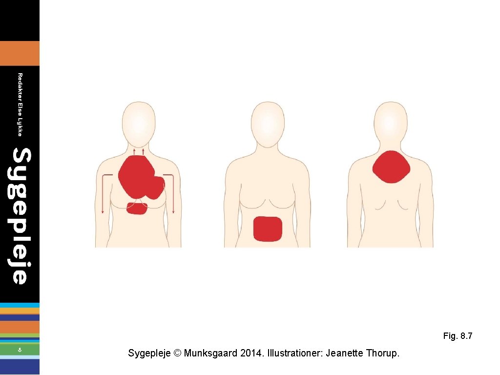 Fig. 8. 7 Sygepleje © Munksgaard 2014. Illustrationer: Jeanette Thorup. 