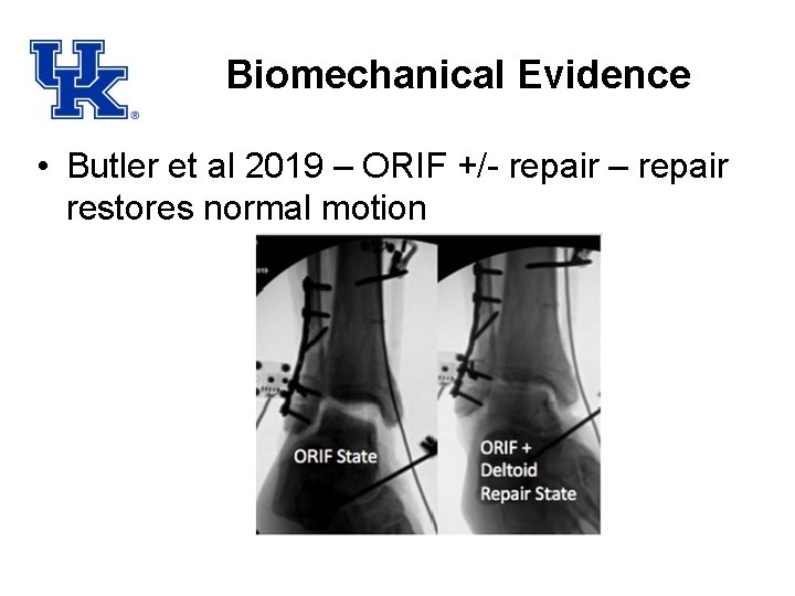 Biomechanical Evidence • Butler et al 2019 – ORIF +/- repair – repair restores