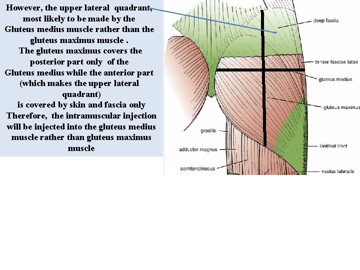 However, the upper lateral quadrant, most likely to be made by the Gluteus medius