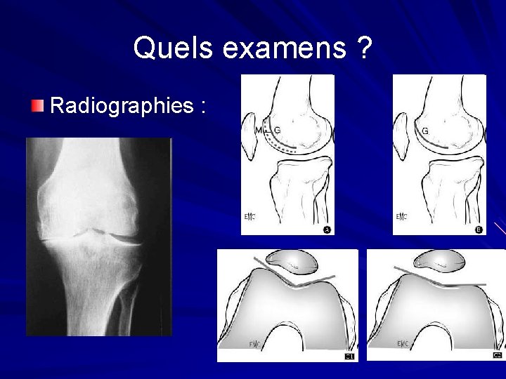 Quels examens ? Radiographies : Quels examens ? Radiographies :