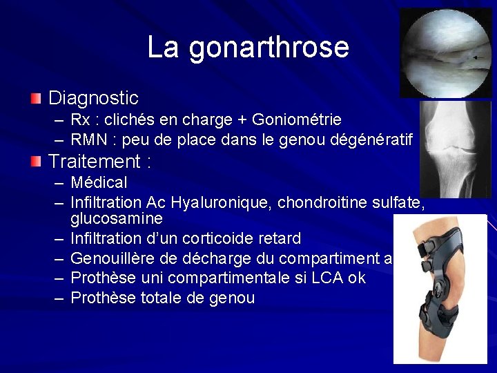 La gonarthrose Diagnostic – Rx : clichés en charge + Goniométrie – RMN : La gonarthrose Diagnostic – Rx : clichés en charge + Goniométrie – RMN :