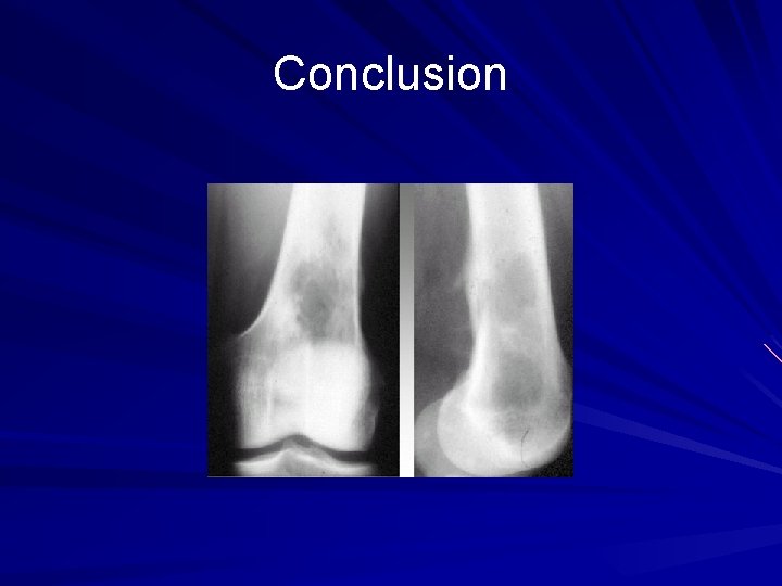 Conclusion Conclusion
