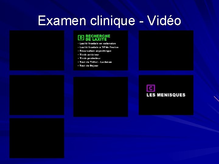 Examen clinique - Vidéo Examen clinique - Vidéo