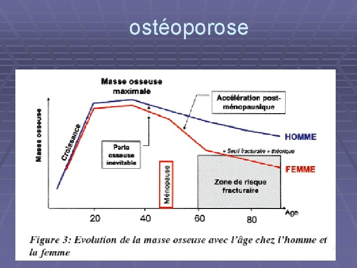 ostéoporose 6 