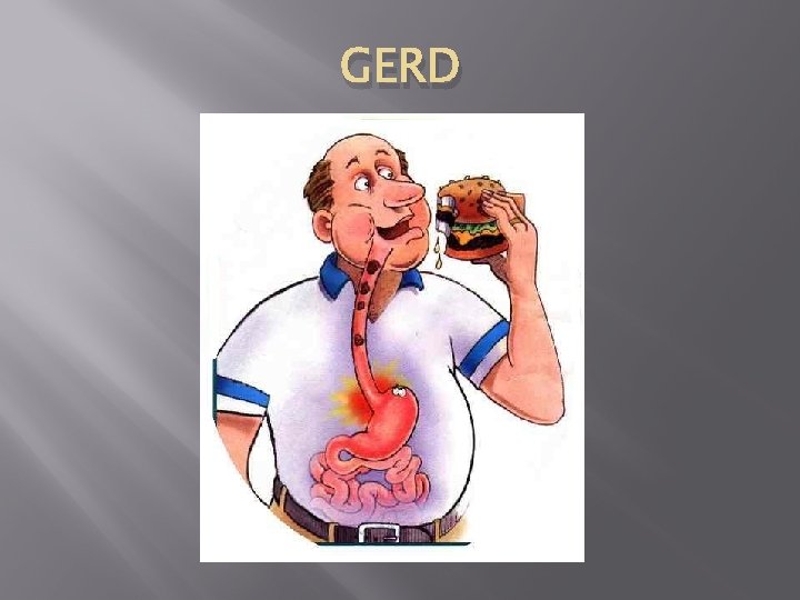 GERD GERD