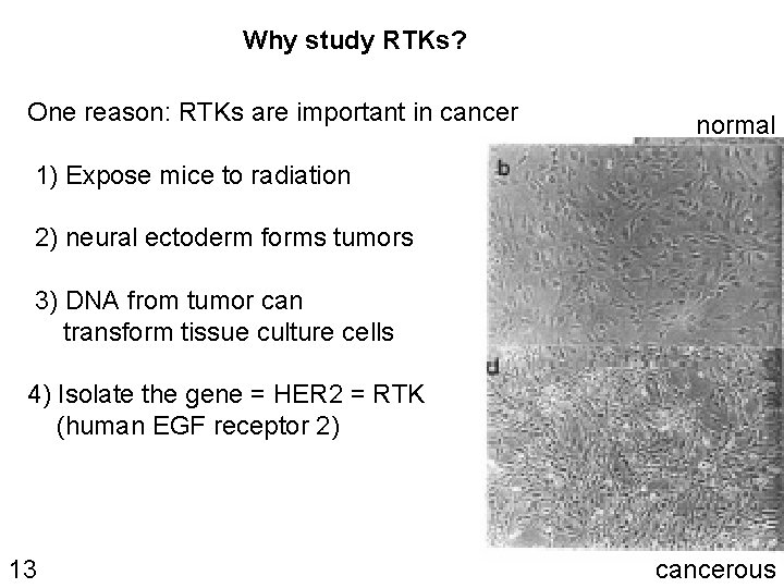 Why study RTKs? One reason: RTKs are important in cancer normal 1) Expose mice Why study RTKs? One reason: RTKs are important in cancer normal 1) Expose mice
