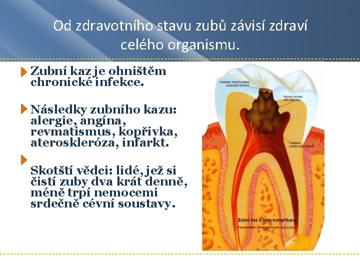 Od zdravotního stavu zubů závisí zdraví celého organismu. Zubní kaz je ohništěm chronické infekce.