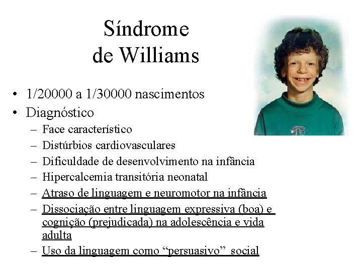 Síndrome de Williams • 1/20000 a 1/30000 nascimentos • Diagnóstico – – – Face