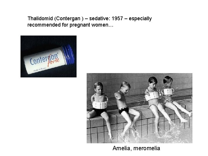Thalidomid (Contergan ) – sedative: 1957 – especially recommended for pregnant women… Amelia, meromelia