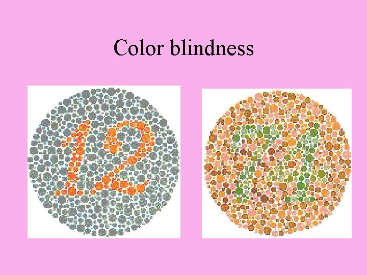 Color blindness 