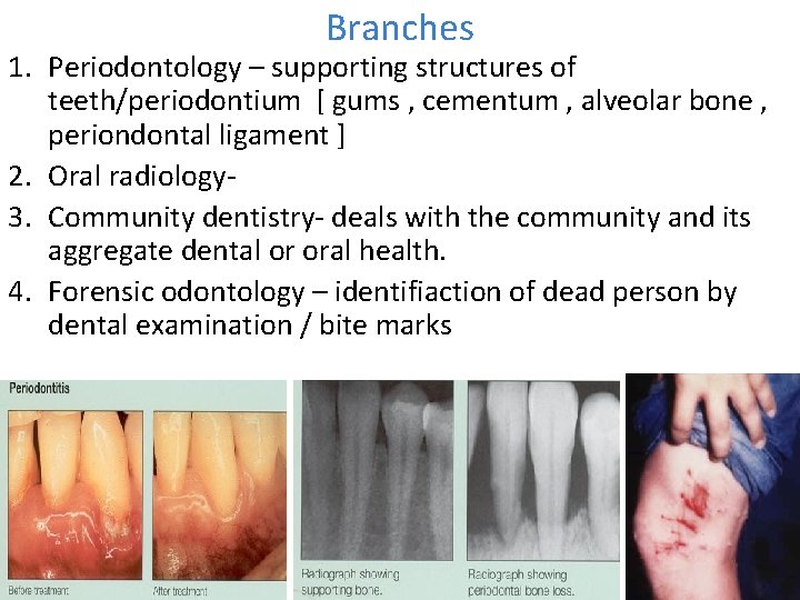 Branches 1. Periodontology – supporting structures of teeth/periodontium [ gums , cementum , alveolar