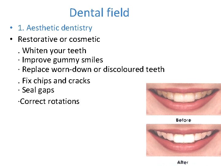 Dental field • 1. Aesthetic dentistry • Restorative or cosmetic. Whiten your teeth ·