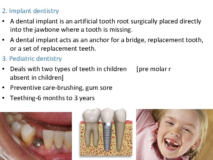 2. Implant dentistry • A dental implant is an artificial tooth root surgically placed