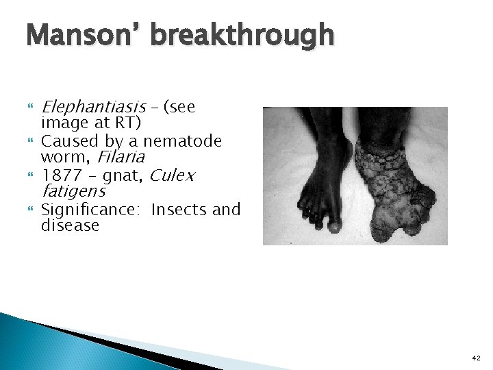 Manson’ breakthrough Elephantiasis – (see image at RT) Caused by a nematode worm, Filaria