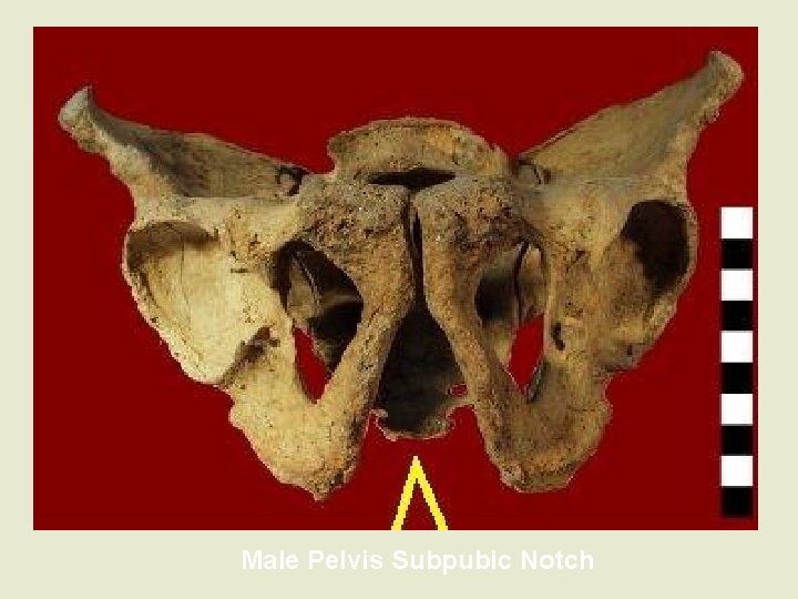 Male Pelvis Subpubic Notch 