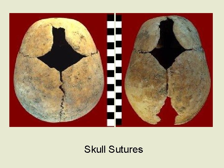 Skull Sutures 