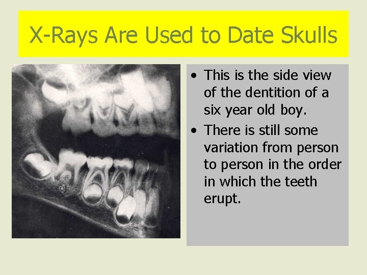 X-Rays Are Used to Date Skulls • This is the side view of the