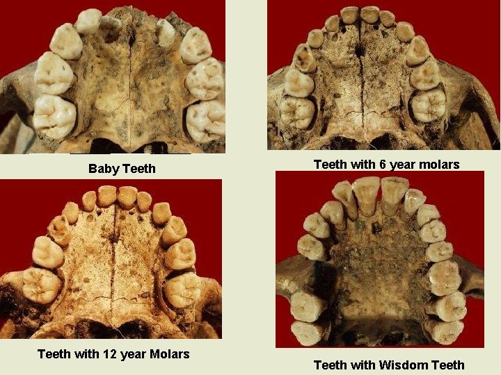 Baby Teeth with 12 year Molars Teeth with 6 year molars Teeth with Wisdom